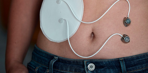  Изкуствен панкреас