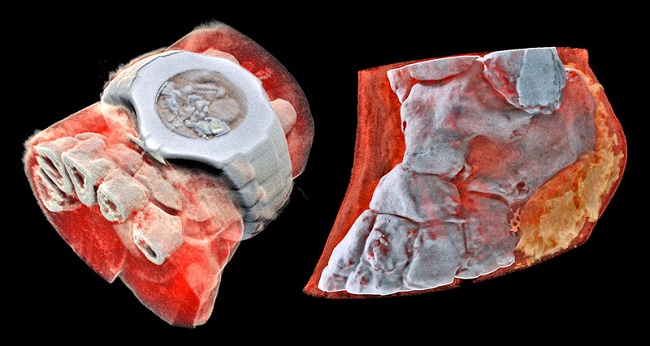  Цветен рентгенов лъч